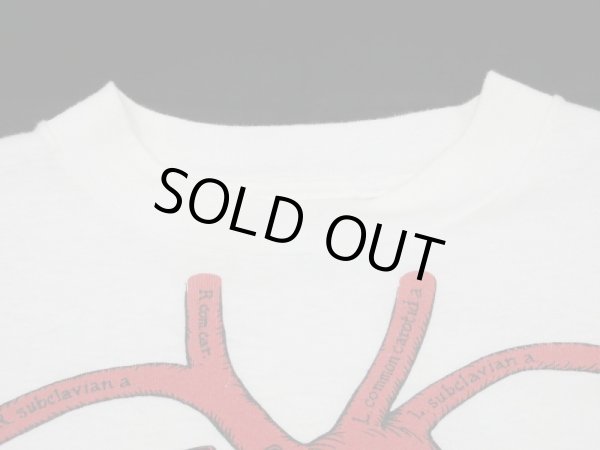 画像4: 80s Hanes HEART CORONARY ARTERY BYPASS PRINT T-SHIRT MADE IN USA (4)