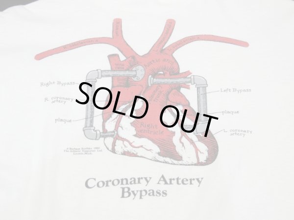 画像5: 80s Hanes HEART CORONARY ARTERY BYPASS PRINT T-SHIRT MADE IN USA (5)